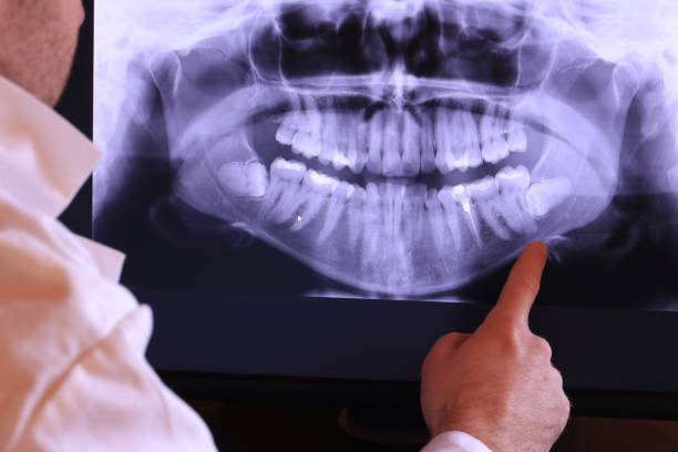 Best Orthodontic Emergency Dentist in South Windham, CT